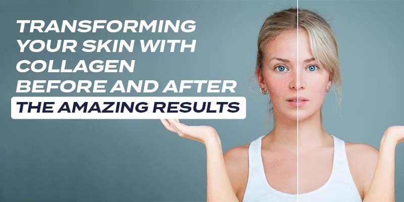 Transforming Your Skin with Collagen Before and After - Image 1